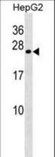 CRYGB Antibody western blot of HepG2 cell line lysates (35 ug/lane). The CRYGB antibody detected the CRYGB protein (arrow).