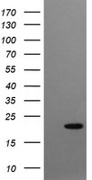 HEK293T cells were transfected with the pCMV6-ENTRY control (Left lane) or pCMV6-ENTRY CRYGC (Right lane) cDNA for 48 hrs and lysed. Equivalent amounts of cell lysates (5 ug per lane) were separated by SDS-PAGE and immunoblotted with anti-CRYGC.