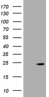 HEK293T cells were transfected with the pCMV6-ENTRY control (Left lane) or pCMV6-ENTRY CRYGC (Right lane) cDNA for 48 hrs and lysed. Equivalent amounts of cell lysates (5 ug per lane) were separated by SDS-PAGE and immunoblotted with anti-CRYGC.