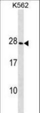 CRYGD Antibody western blot of K562 cell line lysates (35 ug/lane). The CRYGD antibody detected the CRYGD protein (arrow).