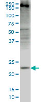 CRYGD monoclonal antibody (M03), clone 4E12 Western Blot analysis of CRYGD expression in HepG2.