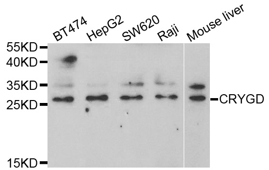 Western blot analysis of extracts of various cell lines, using CRYGD antibody.