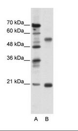 A: Marker, B: Jurkat Cell Lysate