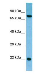 CRYGS antibody Western Blot of Rat Testis.