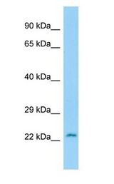 CRYGS antibody Western Blot of Rat Stomach.