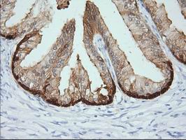 IHC of paraffin-embedded Human prostate tissue using anti-CRYM mouse monoclonal antibody. (Dilution 1:50).