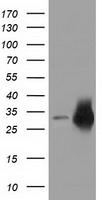 HEK293T cells were transfected with the pCMV6-ENTRY control (Left lane) or pCMV6-ENTRY CRYM (Right lane) cDNA for 48 hrs and lysed. Equivalent amounts of cell lysates (5 ug per lane) were separated by SDS-PAGE and immunoblotted with anti-CRYM.
