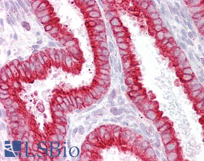 Anti-CHRNB4 antibody IHC of human uterus. Immunohistochemistry of formalin-fixed, paraffin-embedded tissue after heat-induced antigen retrieval. Antibody LS-B6472 concentration 2.5 ug/ml.