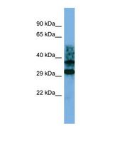 Western blot of Human Jurkat. CRYZL1 antibody dilution 1.0 ug/ml.