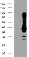 HEK293T cells were transfected with the pCMV6-ENTRY control (Left lane) or pCMV6-ENTRY CRYZL1 (Right lane) cDNA for 48 hrs and lysed. Equivalent amounts of cell lysates (5 ug per lane) were separated by SDS-PAGE and immunoblotted with anti-CRYZL1.