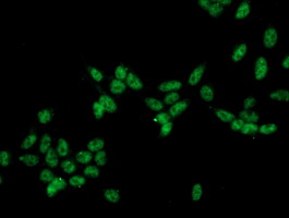 Immunofluorescent staining of HeLa cells using anti-CRYZL1 mouse monoclonal antibody.