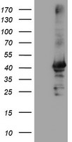 HEK293T cells were transfected with the pCMV6-ENTRY control (Left lane) or pCMV6-ENTRY CRYZL1 (Right lane) cDNA for 48 hrs and lysed. Equivalent amounts of cell lysates (5 ug per lane) were separated by SDS-PAGE and immunoblotted with anti-CRYZL1.