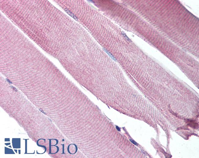 Anti-CHRND antibody IHC of human skeletal muscle. Immunohistochemistry of formalin-fixed, paraffin-embedded tissue after heat-induced antigen retrieval. Antibody LS-B1188 concentration 5 ug/ml.