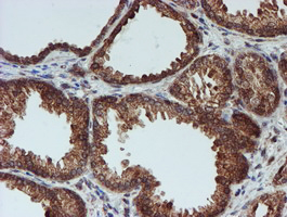 IHC of paraffin-embedded Human prostate tissue using anti-CRYZL1 mouse monoclonal antibody. (Heat-induced epitope retrieval by 10mM citric buffer, pH6.0, 100C for 10min).