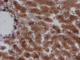 IHC of paraffin-embedded Human liver tissue using anti-CRYZL1 mouse monoclonal antibody. (Heat-induced epitope retrieval by 10mM citric buffer, pH6.0, 100C for 10min).