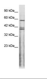 Jurkat Cell Lysate