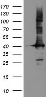 HEK293T cells were transfected with the pCMV6-ENTRY control (Left lane) or pCMV6-ENTRY CRYZL1 (Right lane) cDNA for 48 hrs and lysed. Equivalent amounts of cell lysates (5 ug per lane) were separated by SDS-PAGE and immunoblotted with anti-CRYZL1.