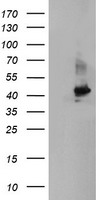 HEK293T cells were transfected with the pCMV6-ENTRY control (Left lane) or pCMV6-ENTRY CRYZL1 (Right lane) cDNA for 48 hrs and lysed. Equivalent amounts of cell lysates (5 ug per lane) were separated by SDS-PAGE and immunoblotted with anti-CRYZL1.