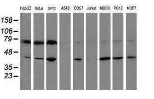 Western blot of extracts (35 ug) from 9 different cell lines by using anti-CRYZL1 monoclonal antibody.