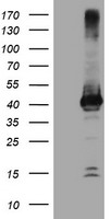 HEK293T cells were transfected with the pCMV6-ENTRY control (Left lane) or pCMV6-ENTRY CRYZL1 (Right lane) cDNA for 48 hrs and lysed. Equivalent amounts of cell lysates (5 ug per lane) were separated by SDS-PAGE and immunoblotted with anti-CRYZL1.