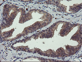 IHC of paraffin-embedded Human prostate tissue using anti-CRYZL1 mouse monoclonal antibody.