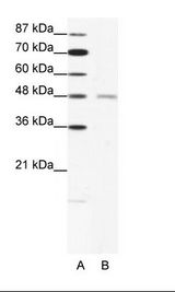 A: Marker, B: HepG2 Cell Lysate