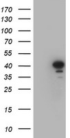 HEK293T cells were transfected with the pCMV6-ENTRY control (Left lane) or pCMV6-ENTRY CRYZL1 (Right lane) cDNA for 48 hrs and lysed. Equivalent amounts of cell lysates (5 ug per lane) were separated by SDS-PAGE and immunoblotted with anti-CRYZL1.