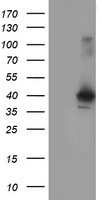 HEK293T cells were transfected with the pCMV6-ENTRY control (Left lane) or pCMV6-ENTRY CRYZL1 (Right lane) cDNA for 48 hrs and lysed. Equivalent amounts of cell lysates (5 ug per lane) were separated by SDS-PAGE and immunoblotted with anti-CRYZL1.