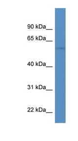CHRND antibody LS-C135025 Western blot of HeLa lysate.