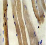 CS Antibody immunohistochemistry of formalin-fixed and paraffin-embedded human skeletal muscle followed by peroxidase-conjugated secondary antibody and DAB staining.