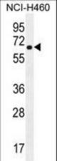 CHRND Antibody western blot of NCI-H460 cell line lysates (35 ug/lane). The CHRND antibody detected the CHRND protein (arrow).