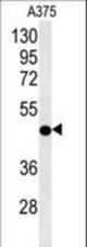 CS Antibody western blot of A375 cell line lysates (35 ug/lane). The CS antibody detected the CS protein (arrow).
