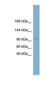 CLSTN1 antibody Western blot of Fetal Kidney lysate.