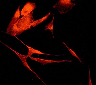 Immunofluorescent staining of SH-SY-5Y cells using anti-Calsyntenin-1 antibody.