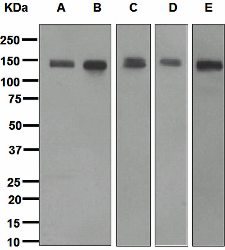 Western blot analysis on (A) fetal brain, (B) 293T, (C) U87-MG, (D) SH-SY5Y, and (E) Neuro-2a lysates using anti-Calsyntenin-1 antibody.