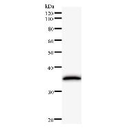 Western blot analysis of immunized recombinant protein, using anti-ERCC8 monoclonal antibody.