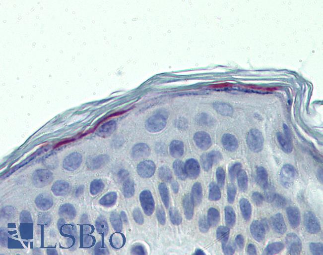 Anti-ERCC8 antibody IHC of human skin. Immunohistochemistry of formalin-fixed, paraffin-embedded tissue after heat-induced antigen retrieval. Antibody LS-B4076 concentration 10 ug/ml.