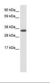 Fetal Skeletal Muscle Lysate