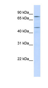ERCC8 antibody LS-C102730 Western blot of Placenta lysate.