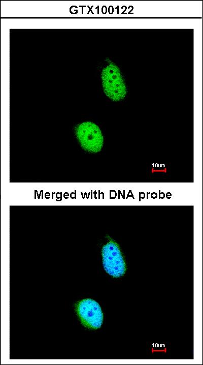 Immunofluorescence of paraformaldehyde-fixed HeLa, using ERCC8 antibody at 1:200 dilution.