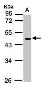 Sample (30g whole cell lysate). A: MOLT4. 10% SDS PAGE. ERCC8 antibody diluted at 1:1000.