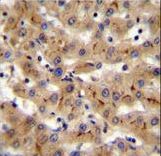 CSAD Antibody immunohistochemistry of formalin-fixed and paraffin-embedded human liver tissue followed by peroxidase-conjugated secondary antibody and DAB staining.