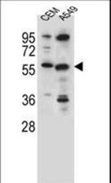 CSAD Antibody western blot of CEM,A549 cell line lysates (35 ug/lane). The CSAD antibody detected the CSAD protein (arrow).