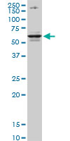 CSAD monoclonal antibody (M02), clone 2C11. Western blot of CSAD expression in HepG2.