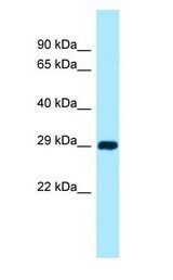 CSAD / CSD antibody Western Blot of 721_B.