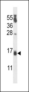 PIPPIN Antibody western blot of MDA-MB231 cell line lysates (35 ug/lane). The PIPPIN antibody detected the PIPPIN protein (arrow).