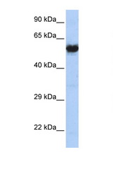 CHRNG antibody LS-C102838 Western blot of MCF7 Cell lysate. Antibody concentration 1 ug/ml.