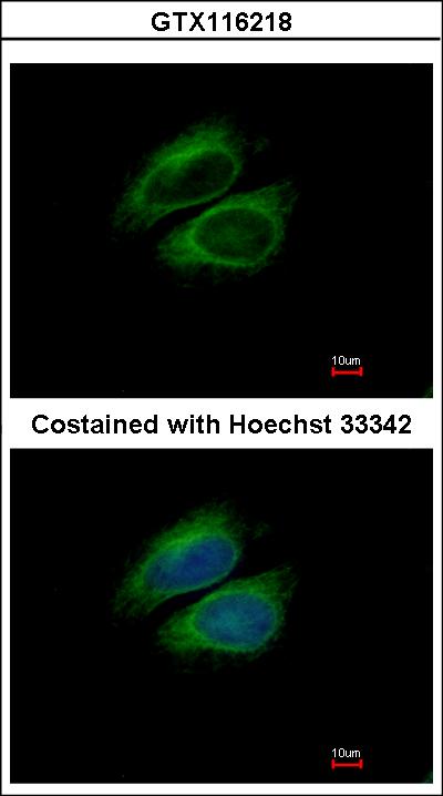 Immunofluorescence of methanol-fixed HeLa using CSDE1 antibody at 1:200 dilution.