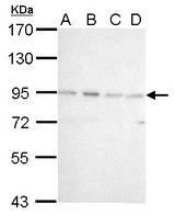 CSDE1 antibody [N2C1], Internal detects CSDE1 protein by Western blot analysis. A. 30 ug 293T whole cell lysate/extract. B. 30 ug A431 whole cell lysate/extract. C. 30 ug HeLa whole cell lysate/extract. D. 30 ug A375 whole cell lysate/extract. 7.5 % SDS-PAGE. CSDE1 antibody [N2C1], Internal dilution:1:1000