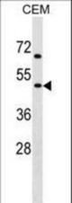 CHRNG Antibody western blot of CEM cell line lysates (35 ug/lane). The CHRNG antibody detected the CHRNG protein (arrow).